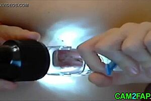 i'm this russian girl on webcam, getting my ass gaped with a speculum... oh god!