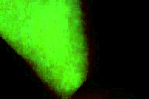 new tattoo with braces