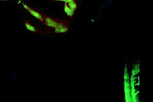 new tattoo with braces