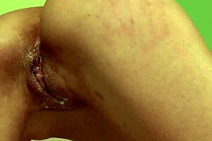 Rough Doctor Dominates Patient in Hospital Bondage