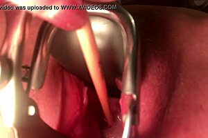 cervix stretching and sounding in extreme detail