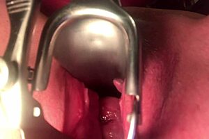 cervix stretching and sounding in extreme detail