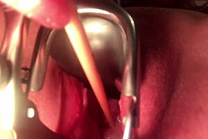 Deep penetration and stretching of the cervix