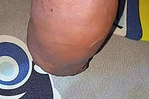 Myanmar gay lover injects saline for monster cock 💉