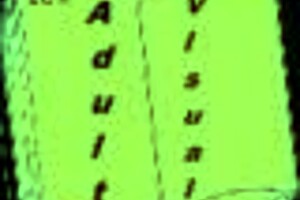 nursing back to pleasure episode 102