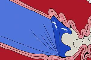 AG H Artist - Frankie in the Wall