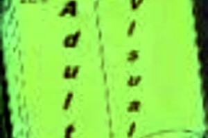 harem hotel episode 257