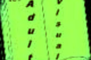 harem hotel game episode 152