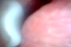 check out the penis close-up with endoscope