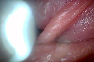 check out the penis close-up with endoscope