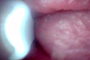 check out the penis close-up with endoscope