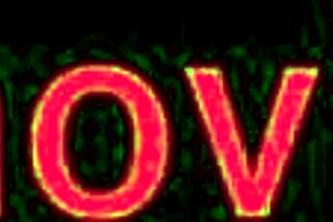 Nurse Massages Patient's Cock!