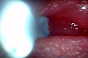 Endoscope Camera Captures Male Ejaculation Moment in Outdoor Creampie Scene