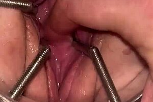Fist Queen Endures Intense Pussy Stretching with Metal Ring in Extreme Session