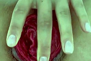 Destroyed anal juicy prolapse asshole close up play